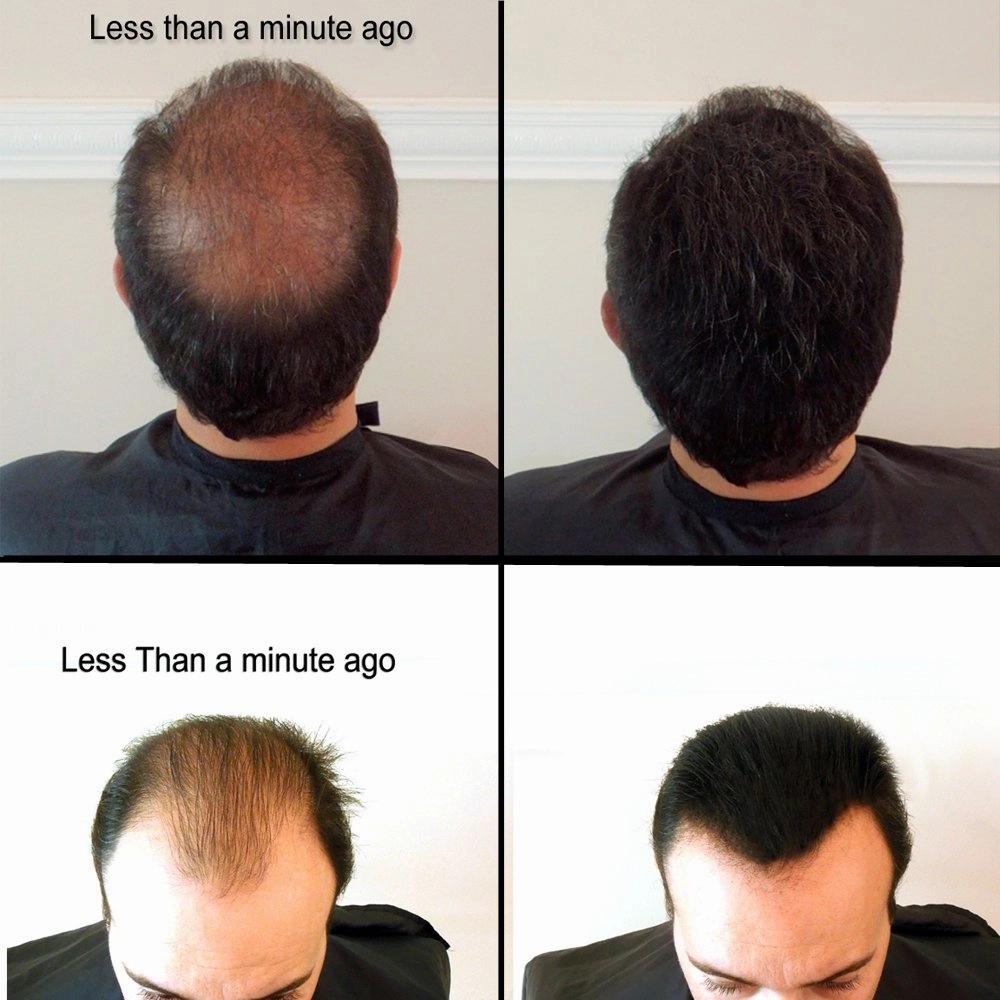 for Thinning Hair - 100% Undetectable Natural Formula - Completely Conceals Hair Loss in Seconds. Covers bald spots. Thicken your hair instantly - 25 Grams Refill (BLONDE)